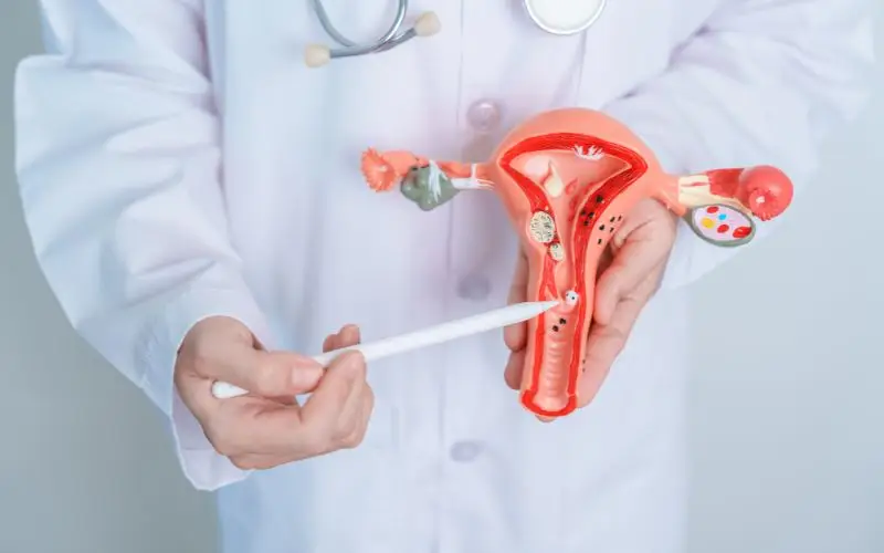endometriosis experts