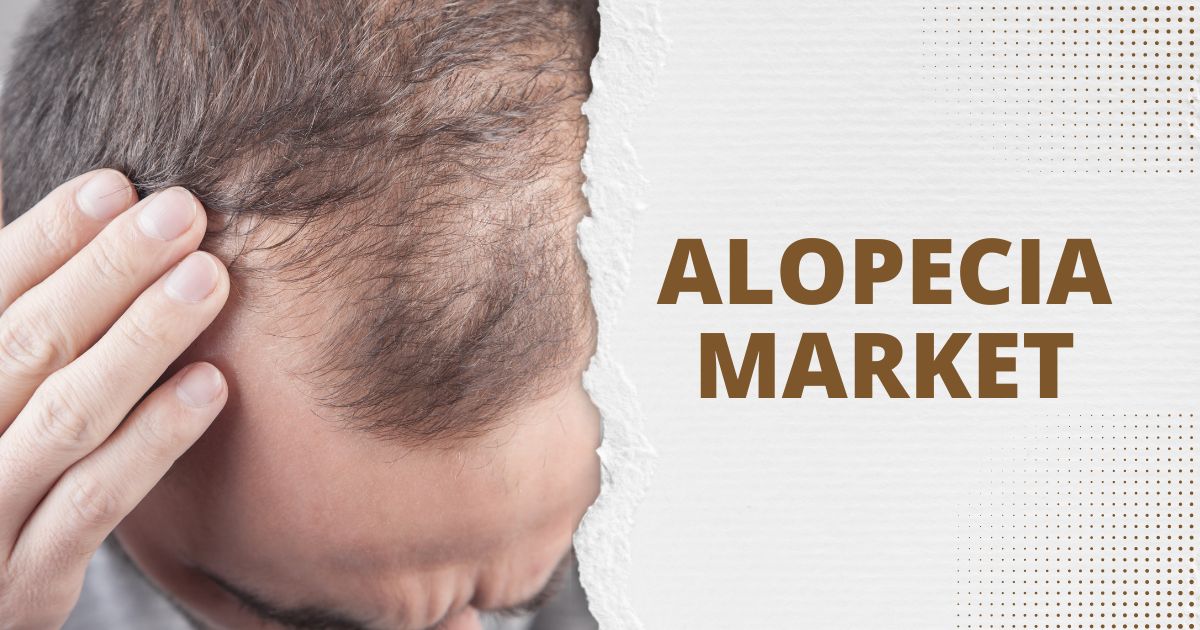 Mercado de Alopecia